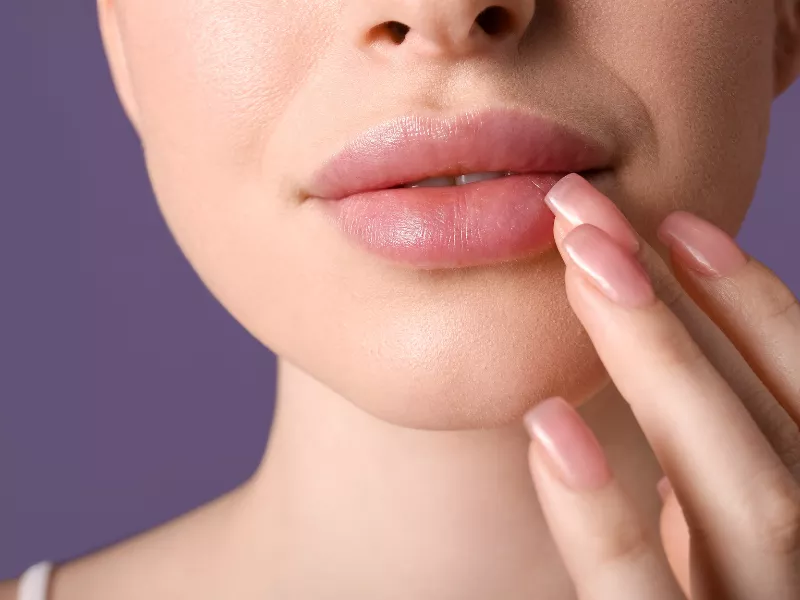 Dudak Kaldırma (Lip Lift)